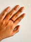 Liam Ring