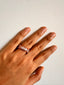 Victor Ring